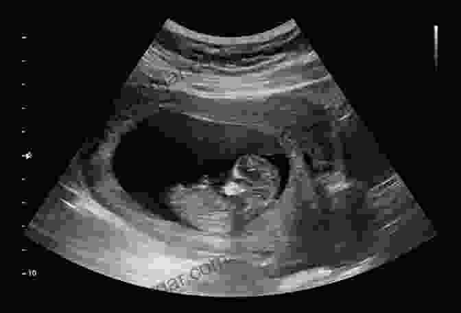 A Sonogram Image Of A Developing Fetus In The Womb The Story Of The Human Body: Evolution Health And Disease