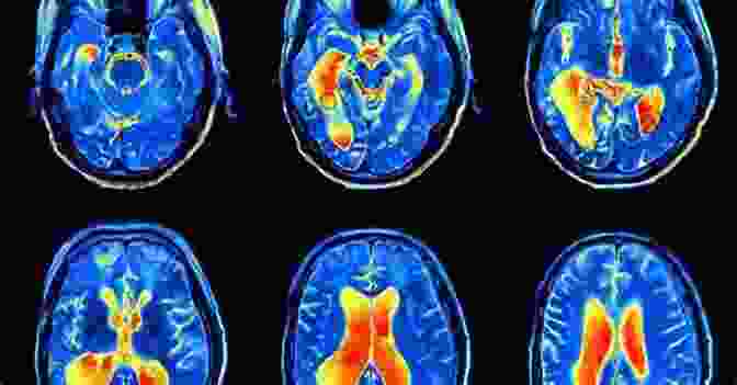 Image Of A Brain Scan Showing Areas Activated During Social Interactions Mirroring People: The New Science Of How We Connect With Others