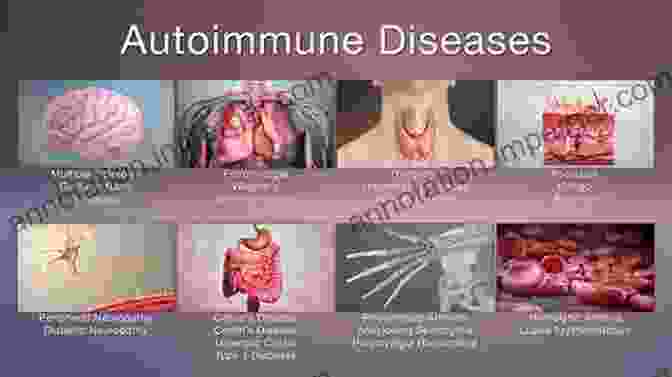 Image Of Immune Related Diseases Immunology: A Comprehensive Review Darla J Wise