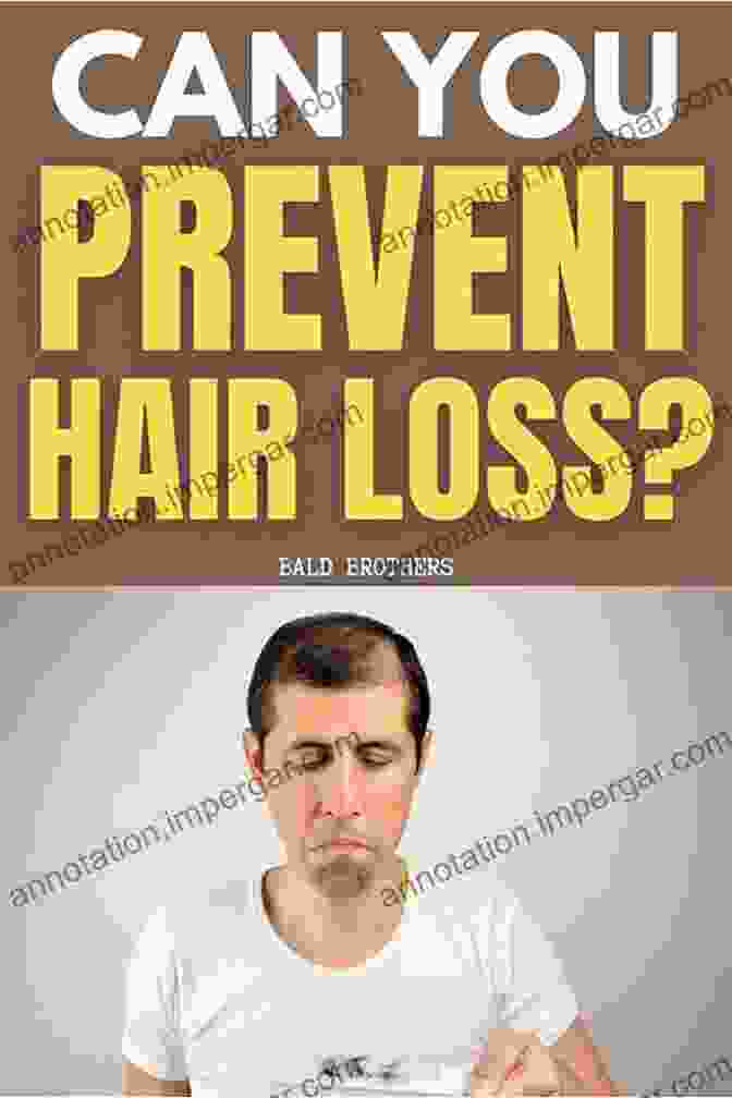 Stop Hair Loss Francisco Bilardo Book Stop Hair Loss Francisco Bilardo