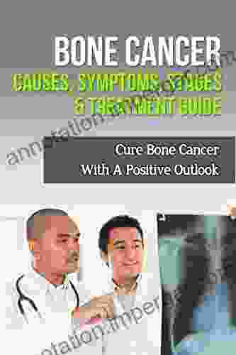 Bone Cancer Causes Symptoms Stages Treatment Guide: Cure Bone Cancer With A Positive Outlook